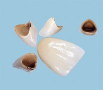 鈷鉻合金烤瓷牙的優(yōu)點(diǎn)有哪些