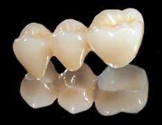 二氧化鋯全瓷牙壽命