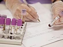 婦科檢查項目都有哪些